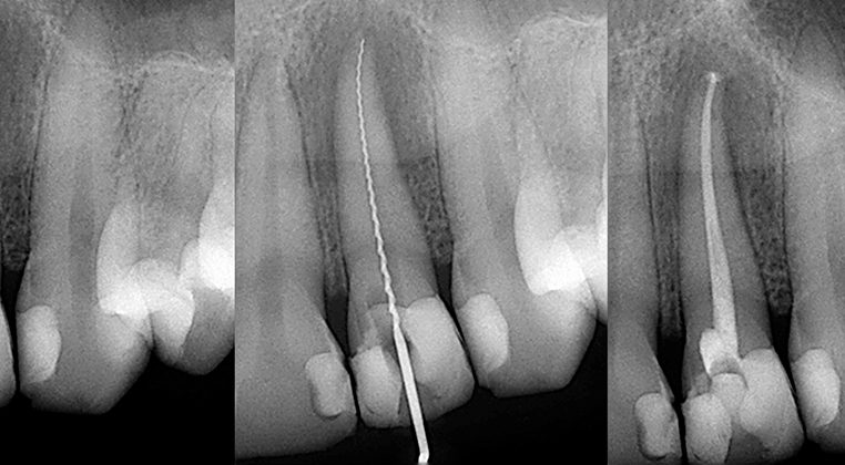 endodontia dentista vizela preço medicare