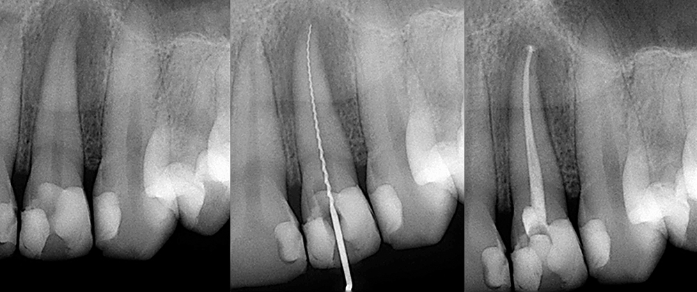 endodontia dentista vizela preço medicare