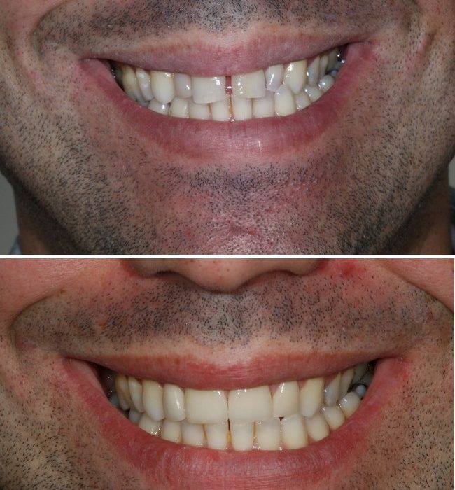 dentista vizela implantes botox ortodontia invisalign branqueamento destartarização acordos seguradoras